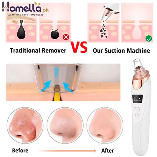 Blackhead Remover Nose T Zone Pore Vacuum Acne Pimple Removal Vacuum Suction Tool Facial Diamond Dermabrasion Machine Face Clean
